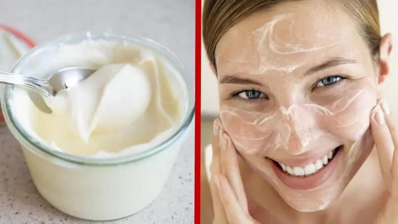 Cremas Caseras para las Manchas